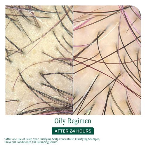 Scalp Sync Clarifying Shampoo - New Biolage | L'Oréal Partner Shop