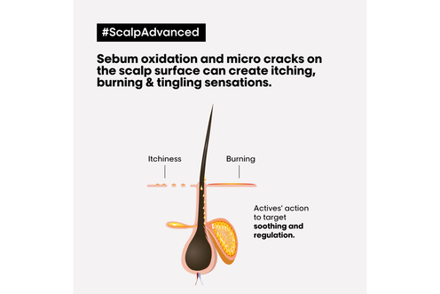 Scalp Advanced Anti-Discomfort Treatment - Serie Expert Retailers | L'Oréal Partner Shop