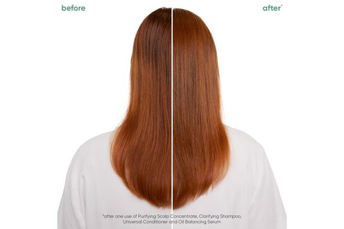 Scalp Sync Clarifying Shampoo - Scalp Sync Reno Collection | L'Oréal Partner Shop