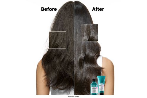 Scalp Advanced Anti-Discomfort Shampoo - Serie Expert Retailers | L'Oréal Partner Shop