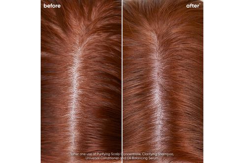 Scalp Sync Clarifying Shampoo - Scalp Sync Reno Collection | L'Oréal Partner Shop