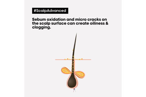 Scalp Advanced Anti-Oiliness Mask - Serie Expert Retailers | L'Oréal Partner Shop