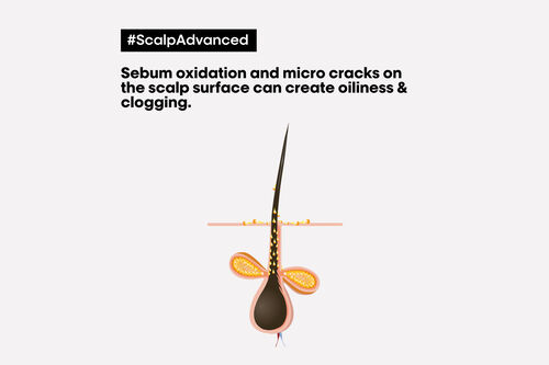 Scalp Advanced Anti Oiliness Shampoo - Serie Expert Retailers | L'Oréal Partner Shop