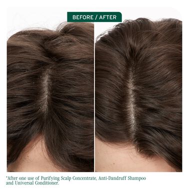 Scalp Sync Purifying Scalp Concentrate - New Biolage | L'Oréal Partner Shop