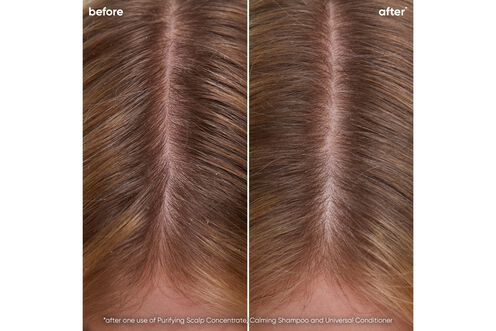 Scalp Sync Calming Shampoo - Scalp Sync Reno Collection | L'Oréal Partner Shop