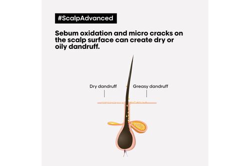 Scalp Advanced Anti-Dandruff Shampoo - Serie Expert Retailers | L'Oréal Partner Shop