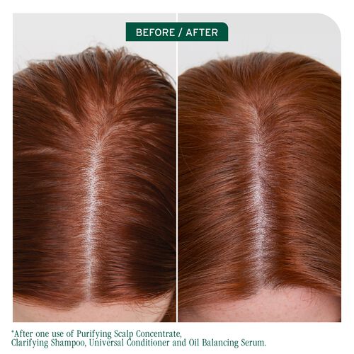 Scalp Sync Clarifying Shampoo - New Biolage | L'Oréal Partner Shop