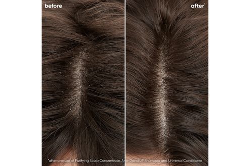 ScalpSync Anti-Dandruff Shampoo - Scalp Sync Reno Collection | L'Oréal Partner Shop