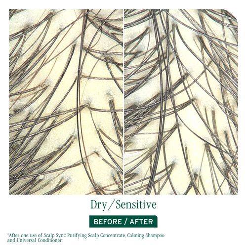 Scalp Sync Purifying Scalp Concentrate - New Biolage | L'Oréal Partner Shop