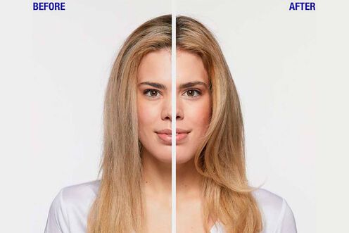 KeratinDose Shampoo - Backbar | L'Oréal Partner Shop