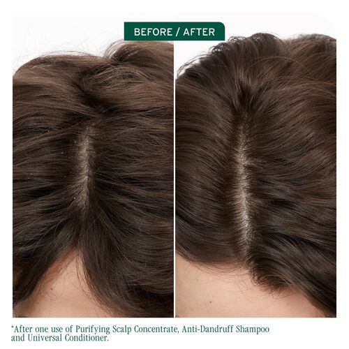 Scalp Sync Anti Dandruff Shampoo - New Biolage | L'Oréal Partner Shop