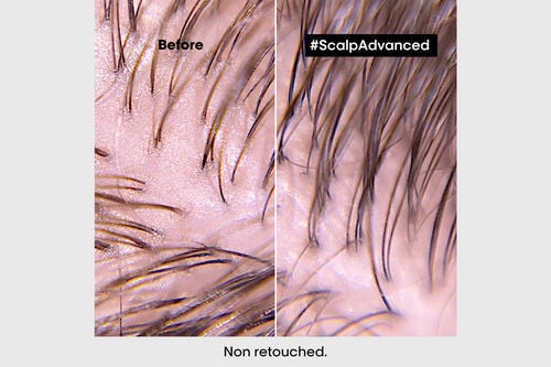 Scalp Advanced Anti Oiliness Shampoo - Serie Expert Retailers | L'Oréal Partner Shop