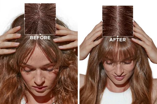 Symbiose Anti-Pelliculaire Serum - Kerastase | L'Oréal Partner Shop