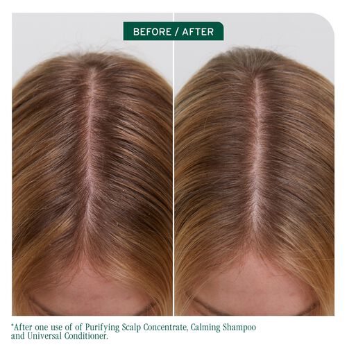 Scalp Sync Universal Conditioner - New Biolage | L'Oréal Partner Shop