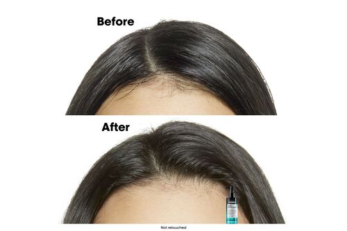 Scalp Advanced Anti-Oilyness Serum - L'Oreal Professionnel | L'Oréal Partner Shop