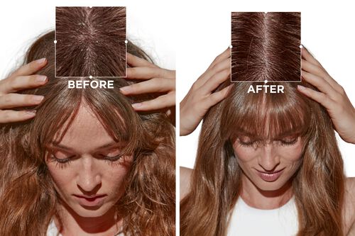 Symbiose Serum Nuit Anti-Pelliculaire Intensif - Maurice Meade Exclusive Retail Products | L'Oréal Partner Shop