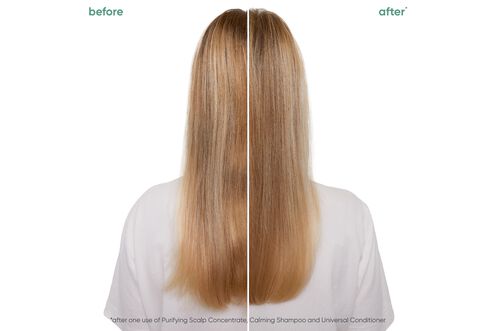 Scalp Sync Calming Shampoo - Scalp Sync Reno Collection | L'Oréal Partner Shop