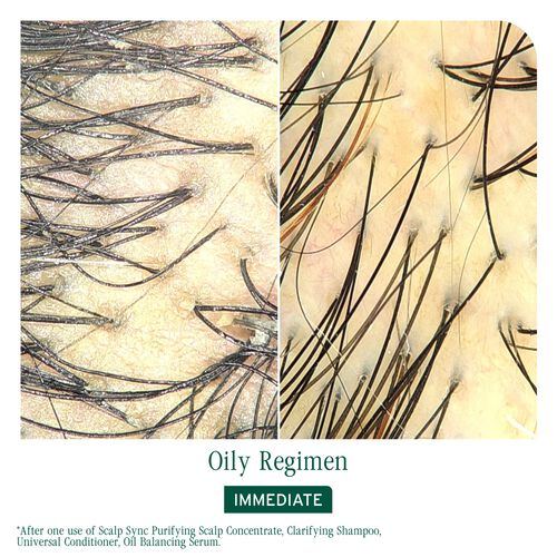 Scalp Sync Oil Balancing Serum - New Biolage | L'Oréal Partner Shop